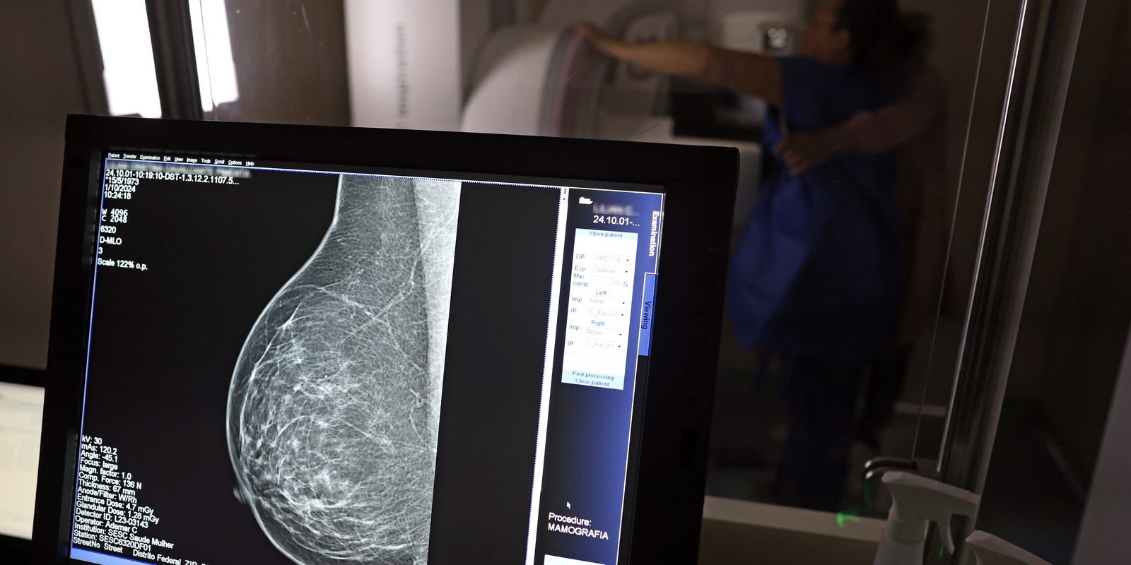 Médicos criam guia para evitar que o pedido de mamografia digital seja negado