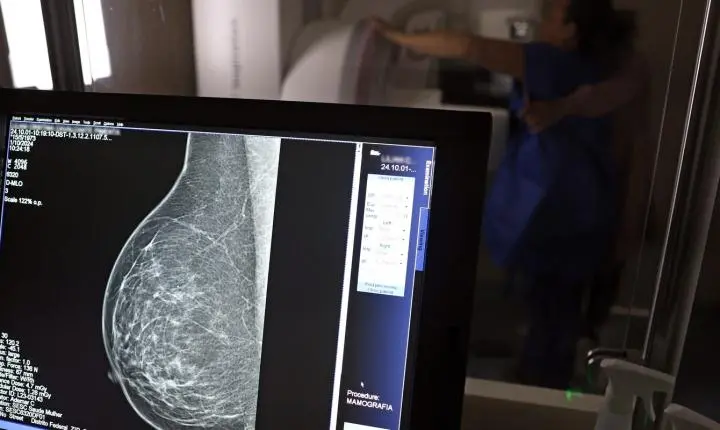 Médicos criam guia para evitar que o pedido de mamografia digital seja negado